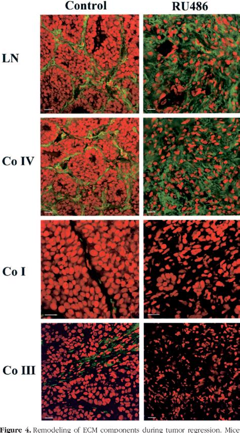 Figure 4 From Tumorigenesis And Neoplastic Progression Involvement Of