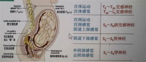 关于“无痛分娩”你应该知道的事 镇痛