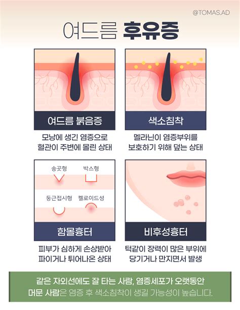 W건강생활백서 피부 불청객 여드름피부흉터·색소침착 치료 방법은