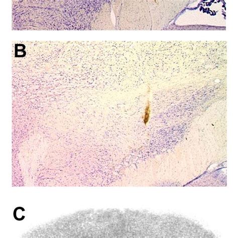 Photomicrographs Of Cresyl Violet Stained Sections Showing