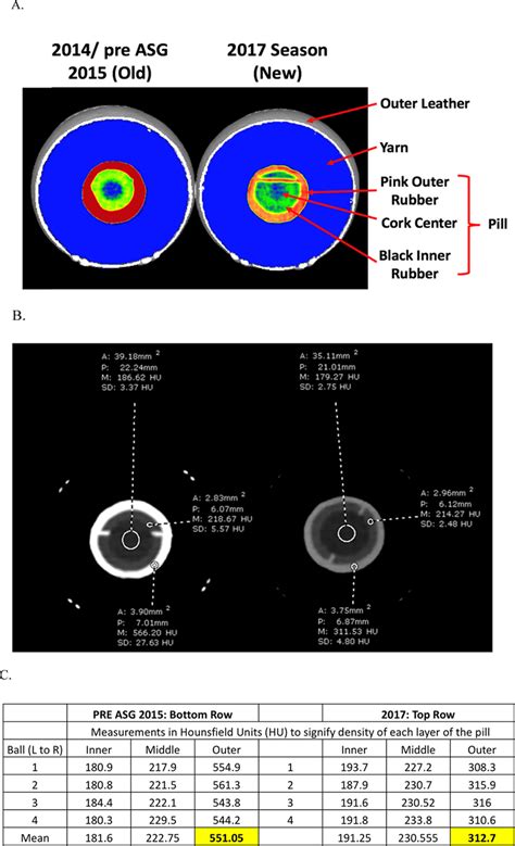 Ct Scans Show A Change In The Radiodensity Of The Inner Pill Of The