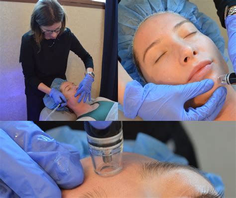 Diamondglow® Dermalinfusion Facial Charlotte Nc