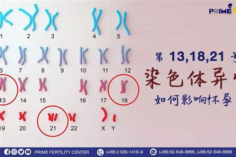 第13、18、21号染色体异常，如何影响怀孕？ 试管婴儿