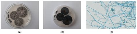 A Lethal Case Of Disseminated Cladosporium Allicinum Infection In A