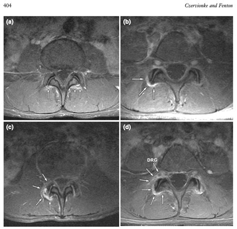 Can We Image Low Back Pain with MRI? - PostGradDC