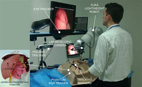 A surgical resident trialing the gaze contingent laparoscope. The ...