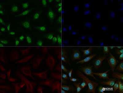 Err Alpha Nr B Antibody Bsa Free Nbp Novus Biologicals