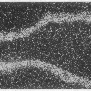 Bright Field A And B And Dark Field C H Photomicrographs Of Neurons