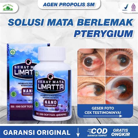 Jual Obat Mata Berlemak Pterygium Penghilang Lamad Di Mata Sehat Mata