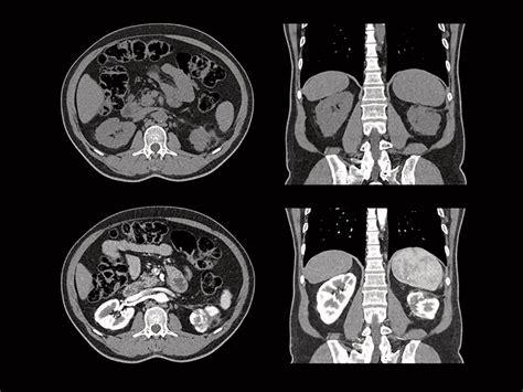 What Is A Ct Scan Computed Tomography Alyeska Imaging