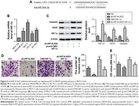 The Inhibitive Effect Of Sh Hif A As On The Proliferation Invasion Ott