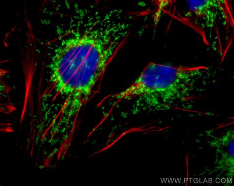 Tom Antibody Cl Proteintech