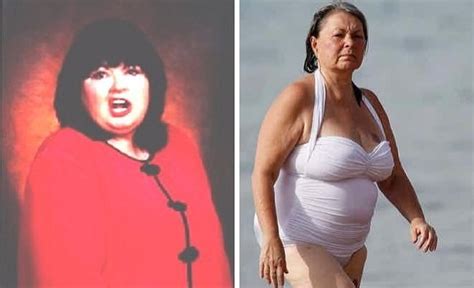 Roseanne Barr Before And After Plastic Surgery Boob Facelift Botox