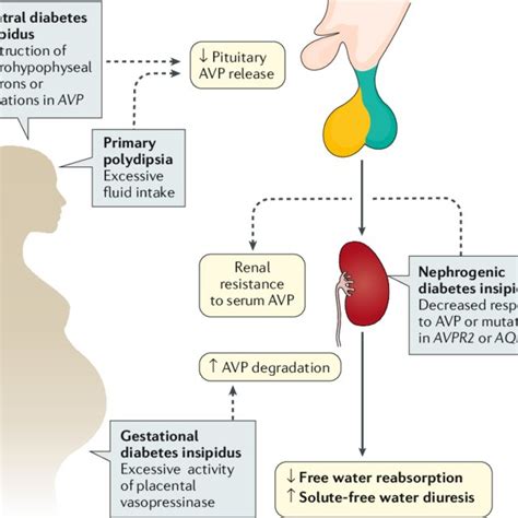 Pathophysiology Of Di Diabetes Insipidus Di Is A Form Of Download Scientific Diagram