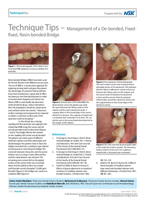 (PDF) Technique tips--management of a de-bonded, fixed-fixed, resin ...