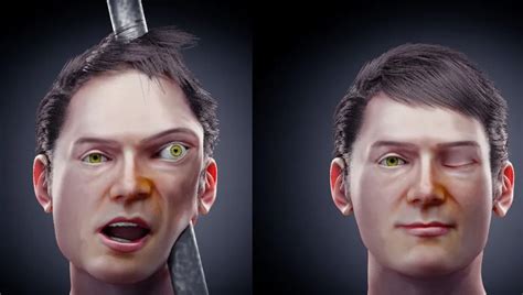 Scientists Reconstruct Face Of Phineas Gage, Who Survived An Iron Bar ...