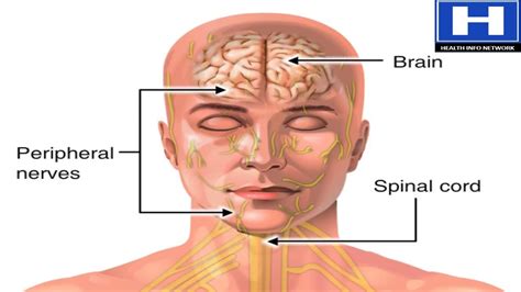 How We Feel Pain Animation Pathway For Sensation Of Pain And Reaction