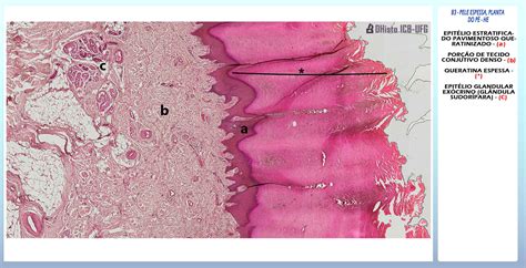 Lamina Tecido Epitelial Estratificado Pavimentoso Nao Queratinizado Images