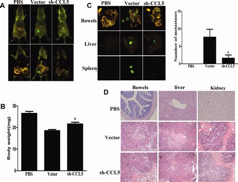 Autocrine Ccl5 Signaling Promotes Invasion And Migration Of Cd133