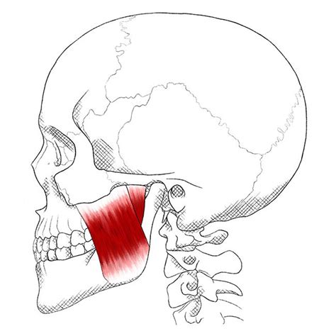 Masseter Schmerzen Und Triggerpunkte Selbst Behandeln Trigger Points