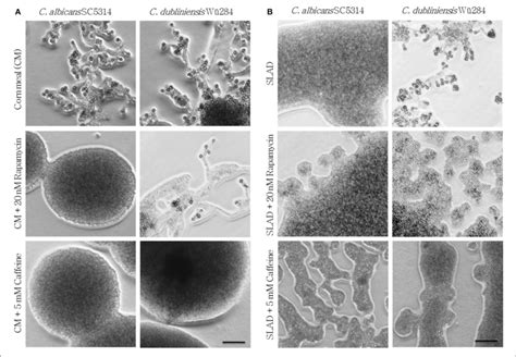 Tor Antagonists Inhibit Chlamydospore Formation Of C Albicans And C