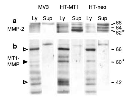 Protein Expression Of Mmp 2 A And Mt1 Mmp B From Tumor Cells