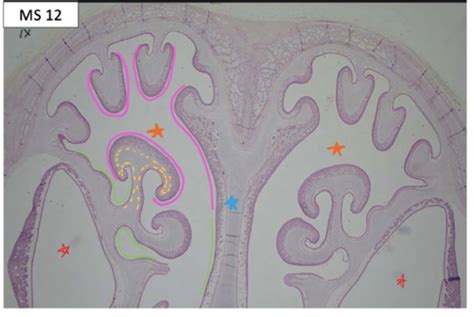 FYFall Histo Respiratory Lab Flashcards Quizlet