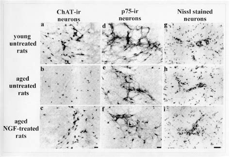 Photomicrographs Of The Magnocellular Basal Nucleus Show The Morphology