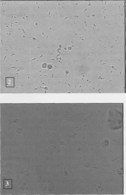 Ceratomyxa Diplodae Spores In Fresh Smear Of Gall Bladder Bar Um