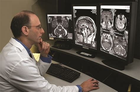 Neurorradiología Miami Neuroscience Institute Baptist Health South