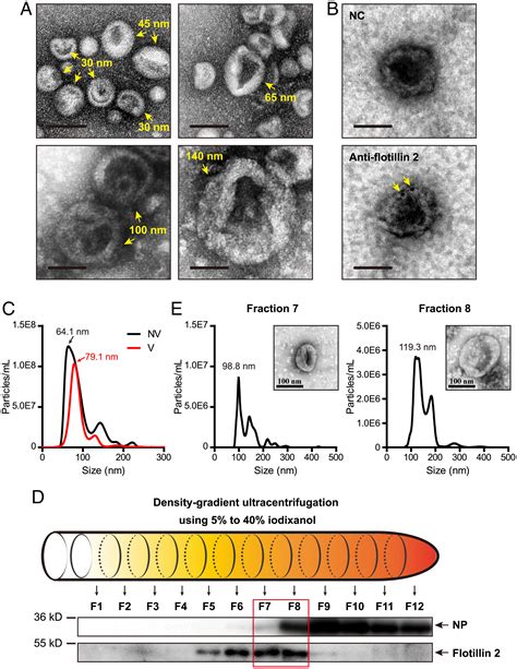 Key Role Of Exportin 6 In Exosome Mediated Viral Transmission From