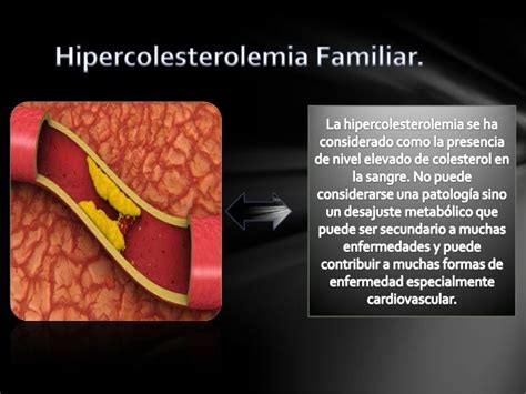 Hipercolesterolemia Familiar