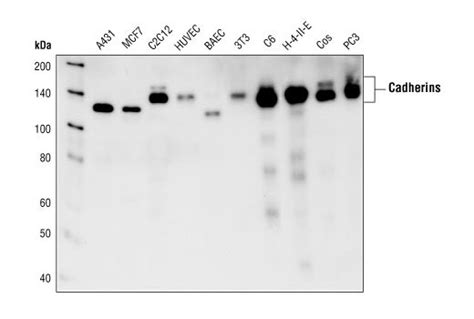 Pan Cadherin Antibody Cell Signaling Technology