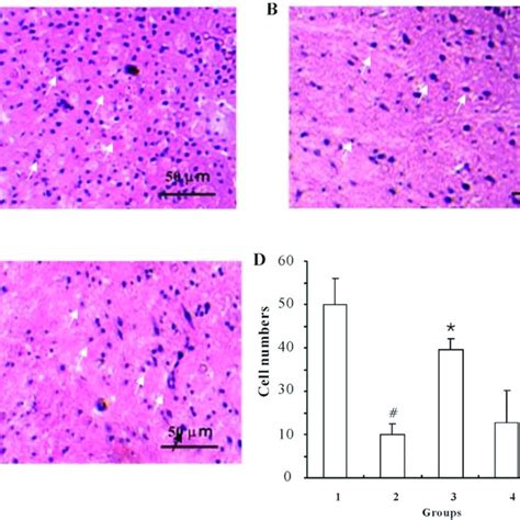 Ischemic Preconditioning Ipc Activates Autophagy In Rats Undergoing