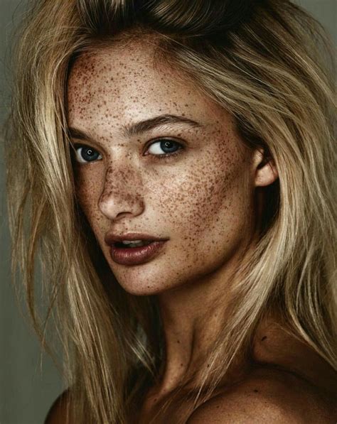 A Woman With Freckles On Her Face