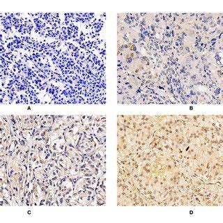 Expression Of Apelin In Ppgls A Negative Immunostaining Of Apelin