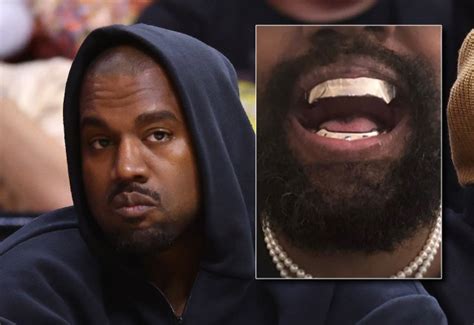 kanye west rep confirms   permanent titanium teeth
