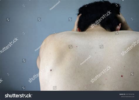 Naked Man Trouble Closeup Stock Photo Shutterstock
