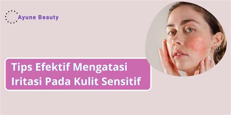 Cara Efektif Mengatasi Iritasi Pada Kulit Sensitif