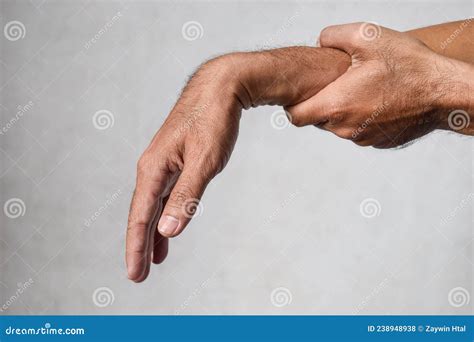 Radial Nerve Injury or Wrist Drop Stock Photo - Image of aging ...