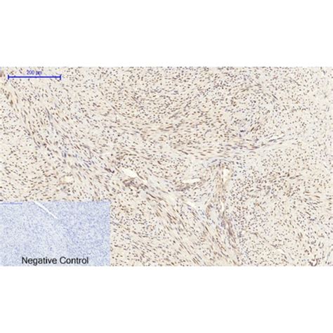 Anti Cebp Beta Antibody A95167