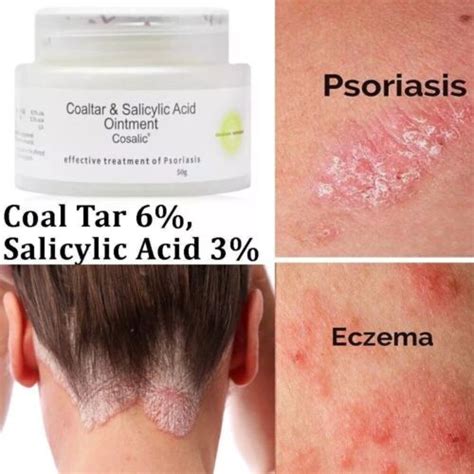 Coal Tar Salicylic Acid Ointment For Psoriasis Gm Very Effective