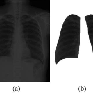 An Example Of A Original Image And B That After Lung Region