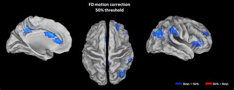 Sex Differences In The Neural Substrates Of Spatial Working Memory