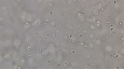 Human Sperm Cell Under Microscope