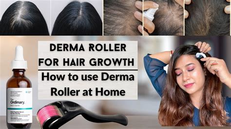 Derma Roller For Hair Growth How To Use The Ordinary Multi Peptide Serum Haircare