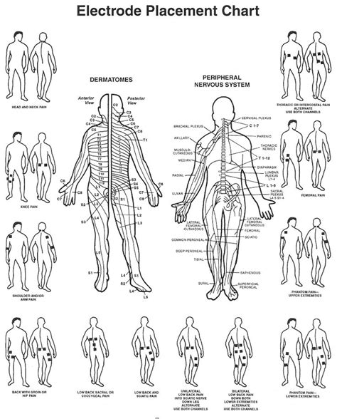 1000+ images about TENS Unit placement charts on Pinterest | The ...