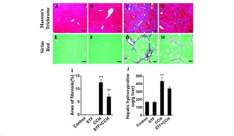 Effects Of Stf 083010 Stf On Ccl 4 Induced Liver Injury And Liver