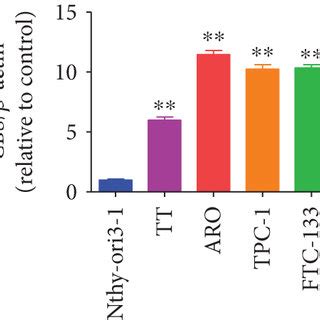 The Expression Levels Of Cbs In Human Thyroid Carcinoma Cell Lines And