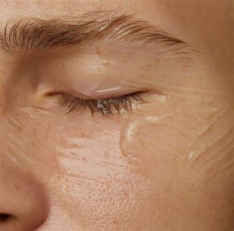 Отделение дерматологии | Доктор Ирина Наумова, [22 апр. 2022 в 20:00 ...